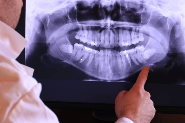 Best Emergency Wisdom Teeth Removal in Magnolia, AR