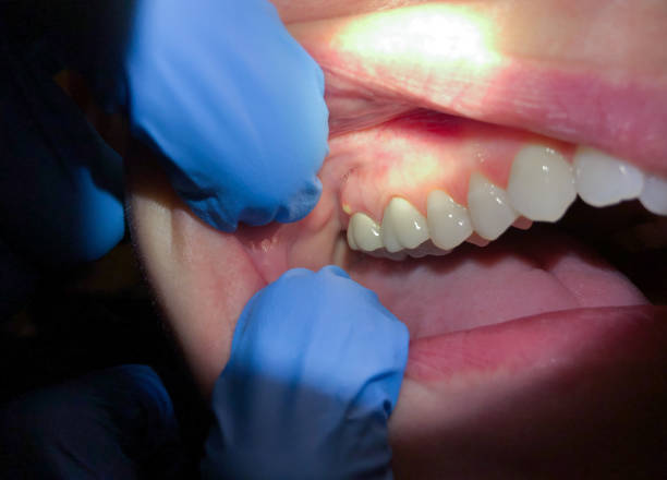 Best Walk-In Emergency Dentist in Magnolia, AR